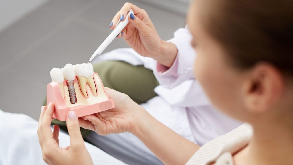 Dentadura Postiza o Implantes-¿Cual es la Mejor Opcion para Tu Sonrisa?_2